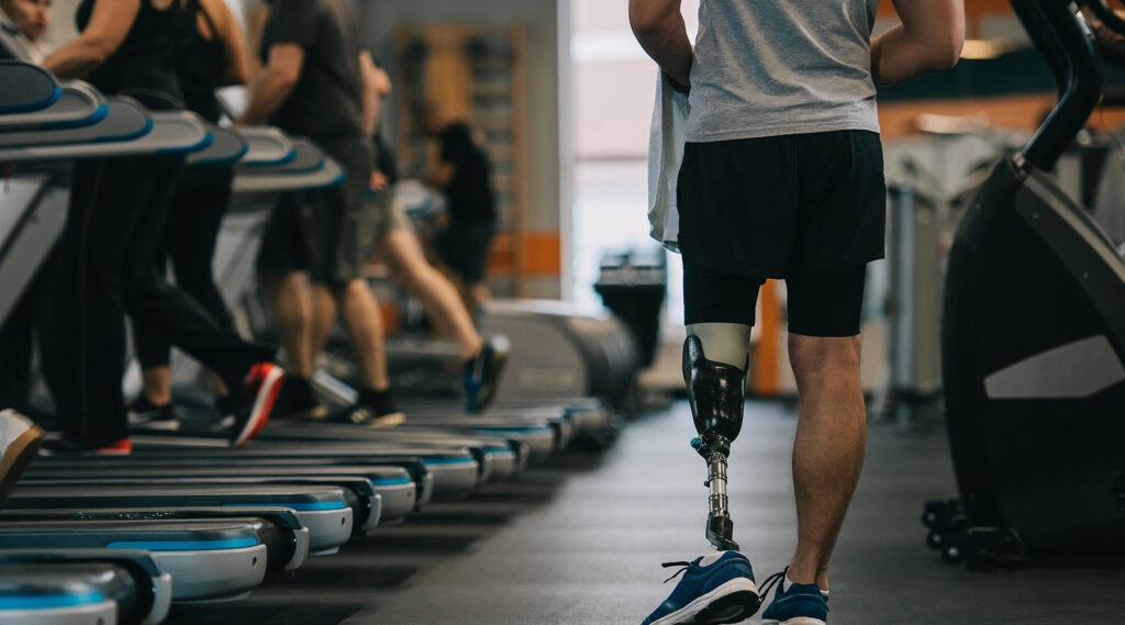 A main with a prosthetic leg managing pain through rehabilitation and assist with chronic pain.